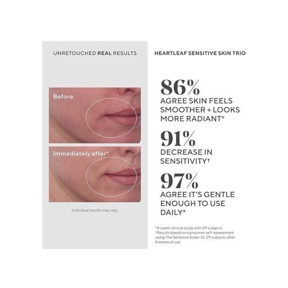 Murad Heartleaf Soothing Cleanser Sensitive Skin 5.0 Oz New In Box Fresh - Picture 2 of 6